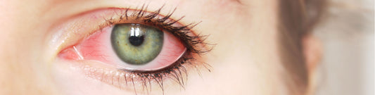 Itchy Eyelids?  It Could Be Mites!