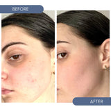 Easy on the Eyes Calming Face Mist with Hypochlorous Acid